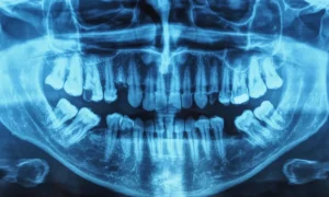 Radiation Safety - X-Ray